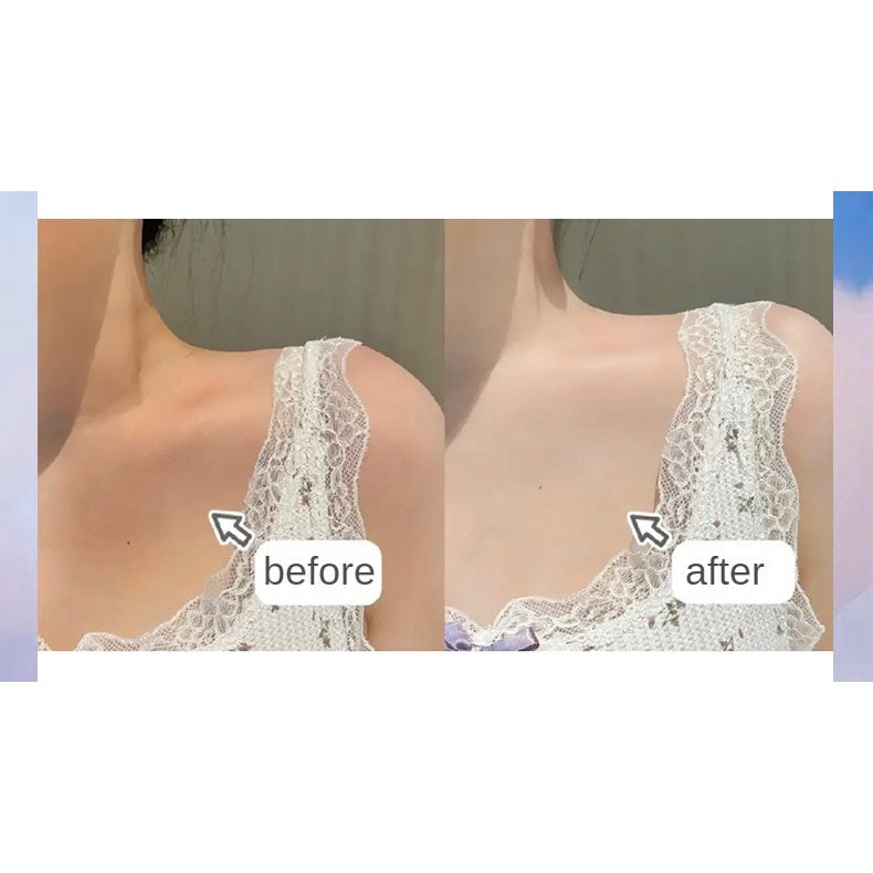 Creme Leite Clareador de Manchas e Pele